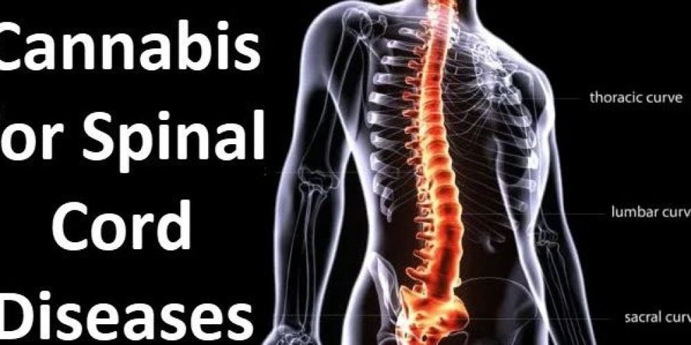 医用大麻对脊髓疾病有什么帮助？
